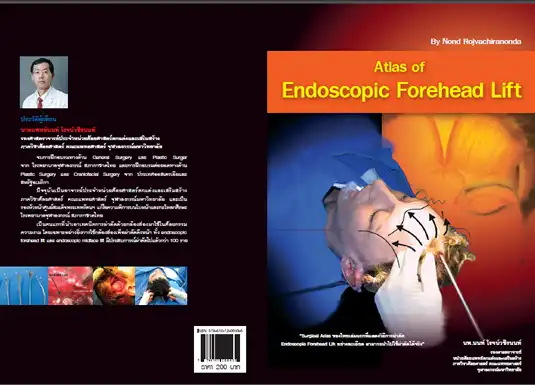 หนังสือของศ. นพ.นนท์ โรจน์วชิรนนท์ Atlas of Endoscopic Forehead Lift