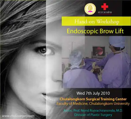 สัมมนา Hands-on Workshop on Endoscopic Forehead Lift จัดโดยนพ.นนท์ โรจน์วชิรนนท์