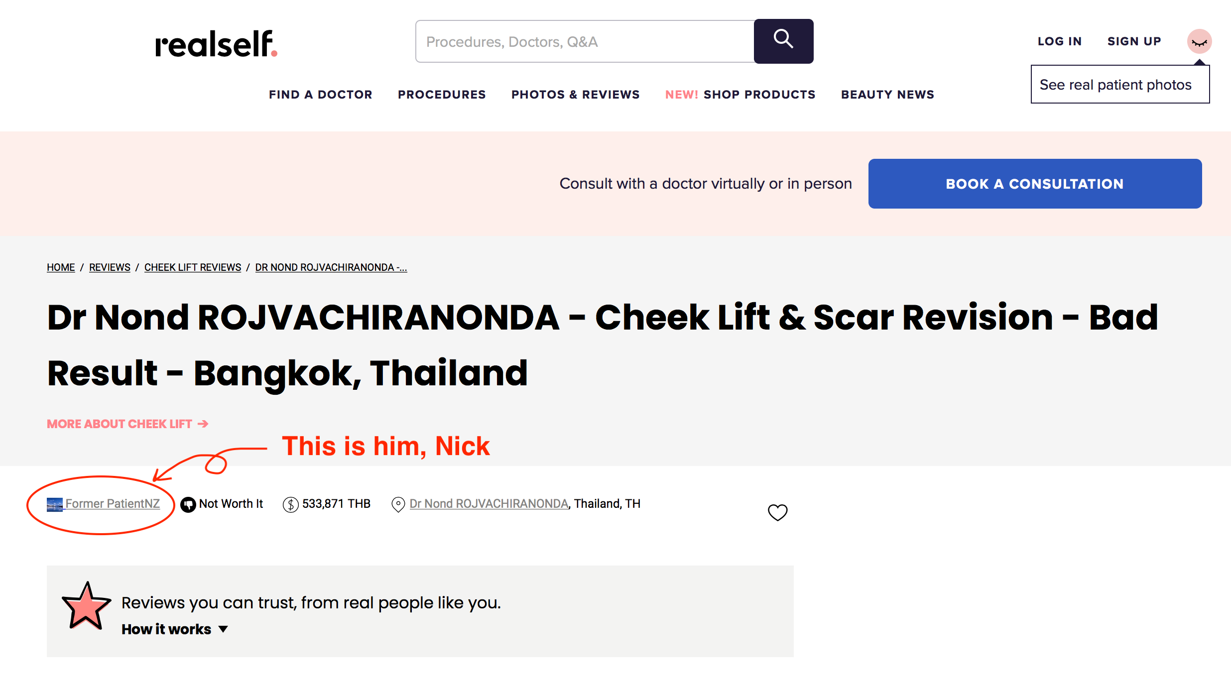 Mr. Nick posted lying messages on Realself.com.